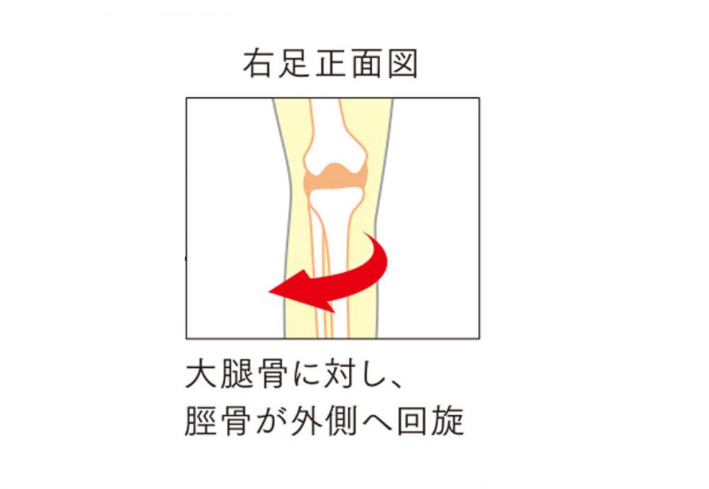 膝に負担がかからない靴 神戸市垂水区 人気